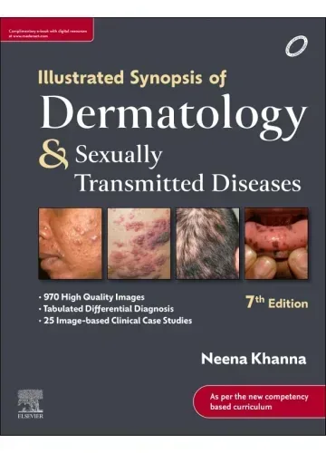 Illustrated Synopsis of Dermatology and Sexually Transmitted Diseases